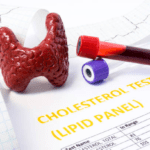 High Cholesterol and Thyroid Issues
