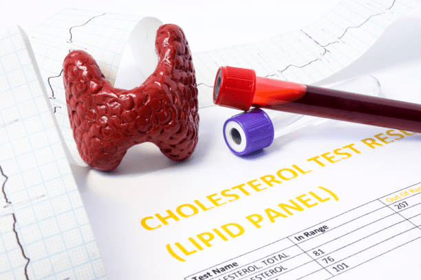 High Cholesterol and Thyroid Issues